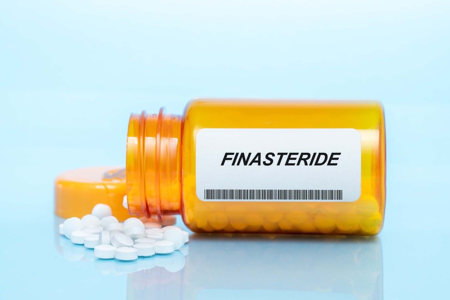 Can You Get Finasteride On The NHS?