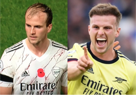 Rob Holding before and after hair transplant