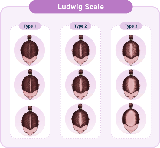 Ludwig Scale