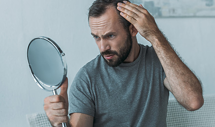 Hair Loss: Symptoms, Causes, Prevention & Treatment