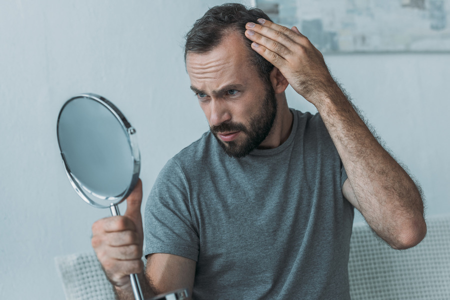 Hair Loss: Symptoms, Causes, Prevention & Treatment