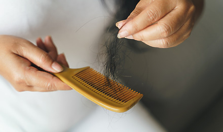 Hair Transplant Shedding: Everything You Need To Know