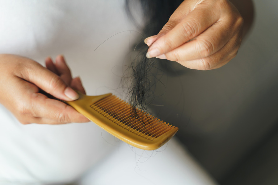 Hair Transplant Shedding: Everything You Need To Know