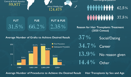 Hair Transplant Statistics 2022