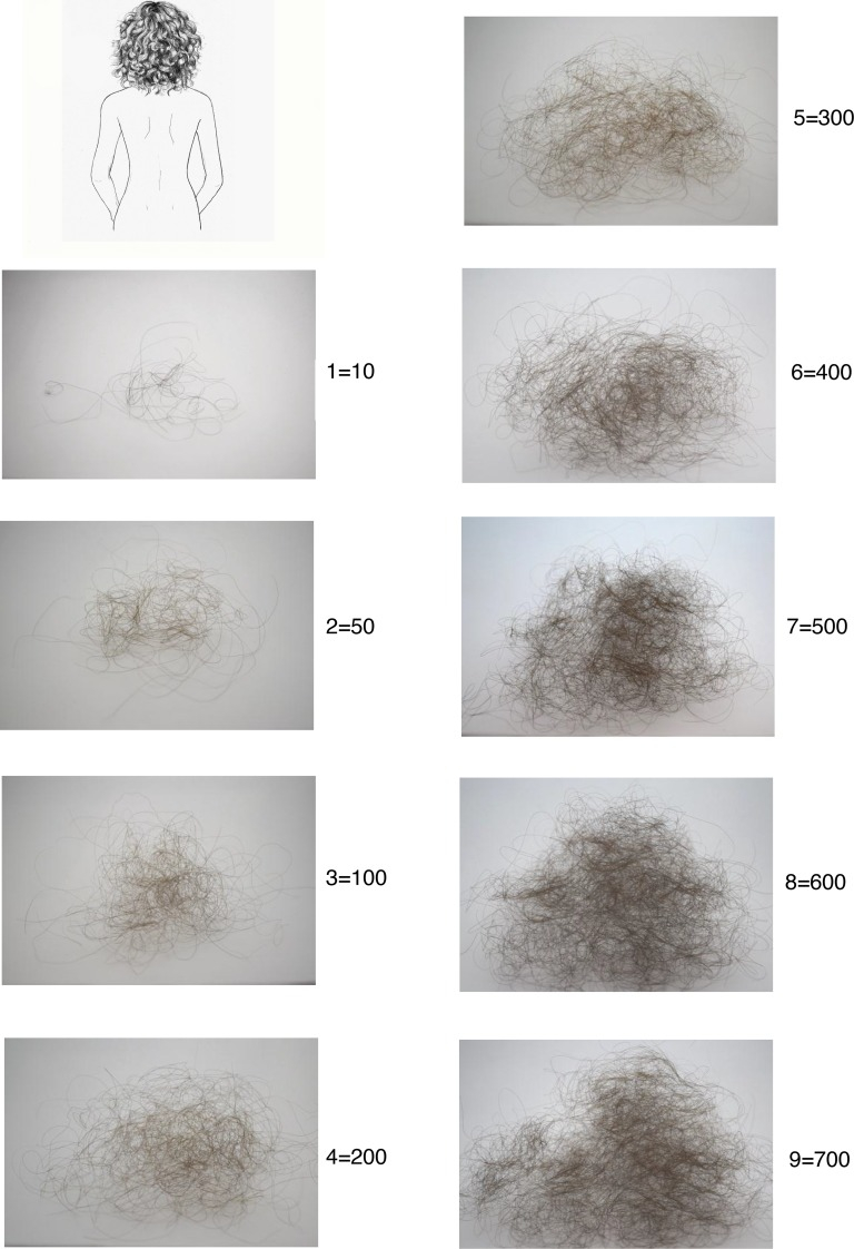 Hair shedding score and equivalent hair loss in women with short hair.