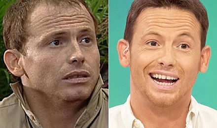 Joe Swash Hair Transplant: Everything You Need To Know