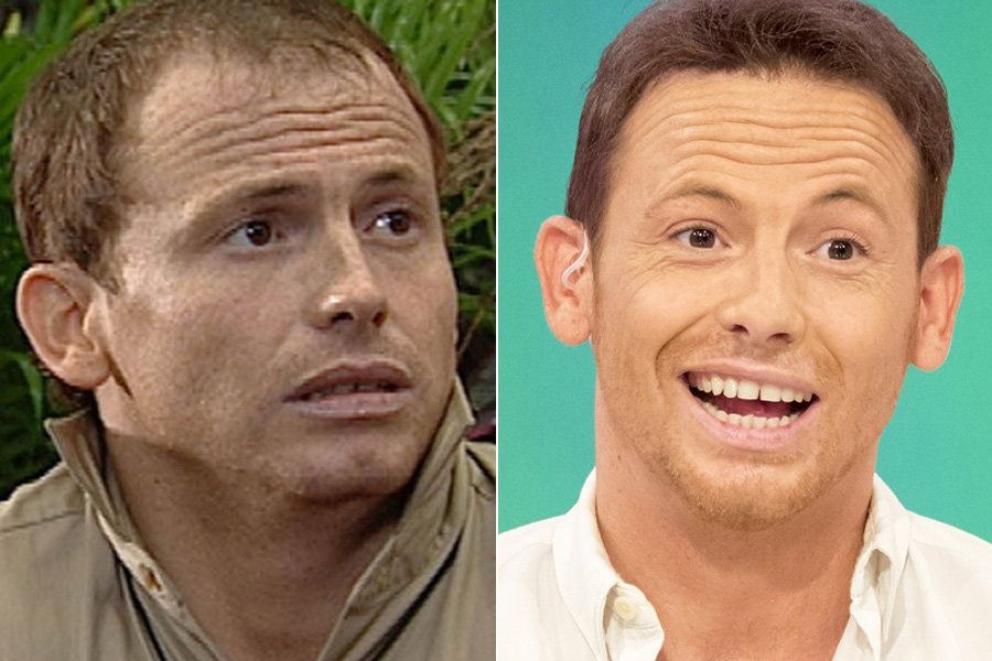 Joe Swash Hair Transplant: Everything You Need To Know