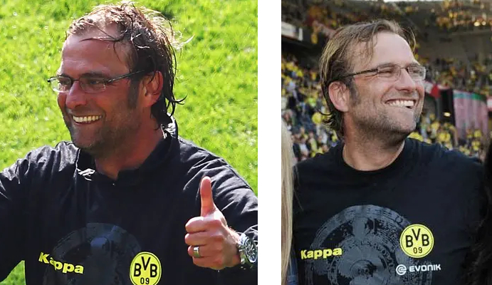 Jurgen Klopp's receding hairline in 2011