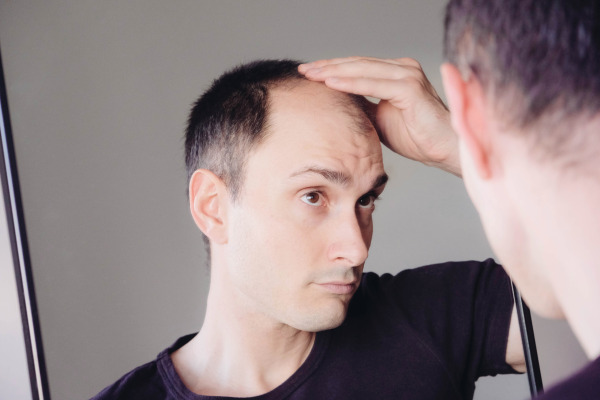 Can Your Hair Grow Back After Balding Naturally?