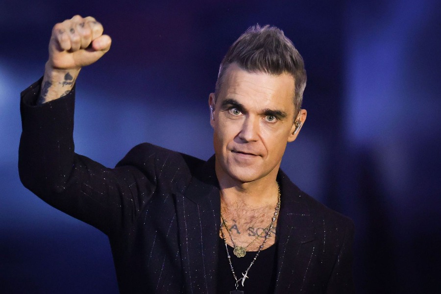 Robbie Williams Hair Transplant