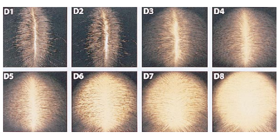 Savin hair density scale