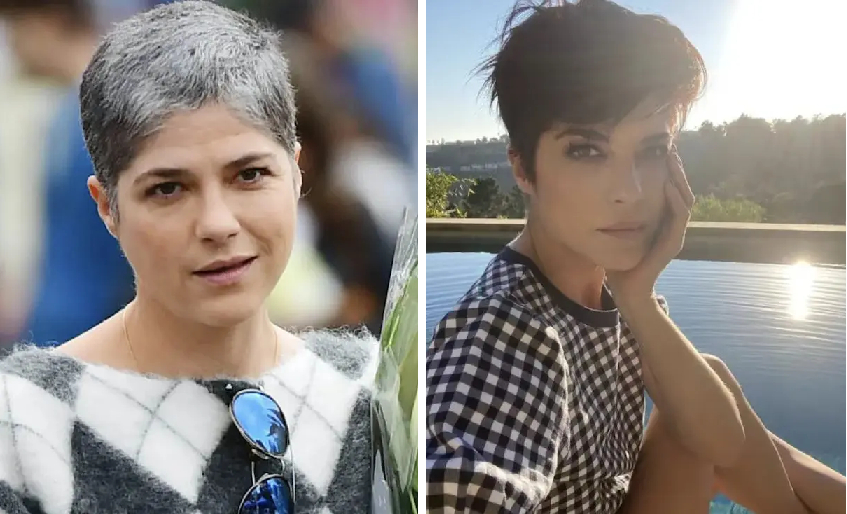 Selma Blair hair loss