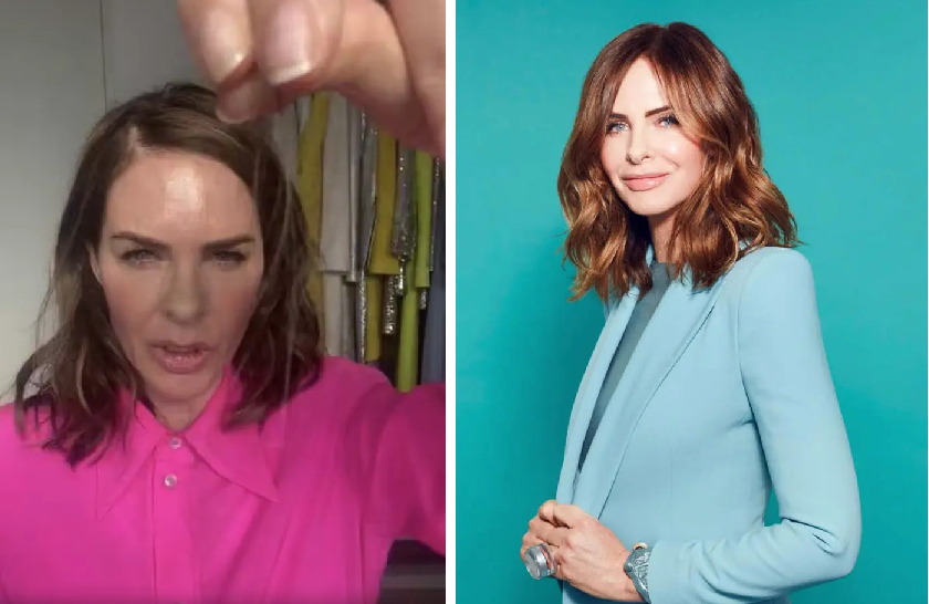 Trinny Woodall hair loss