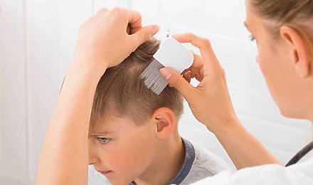 Childhood Hair Losses: What Are The Causes?