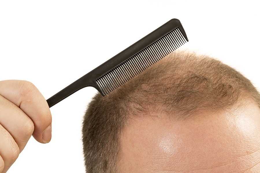 8 Common Scalp Problems: Photos, Causes, Treatments