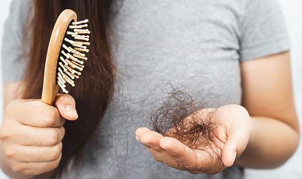 Hair Shedding In Hand