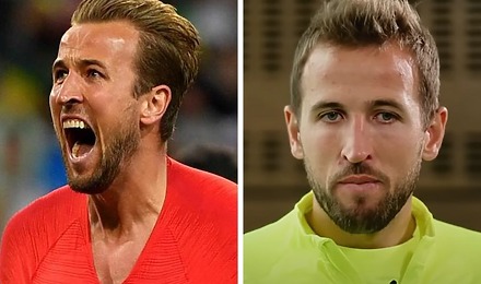 Harry Kane Hair Transplant Featured Image