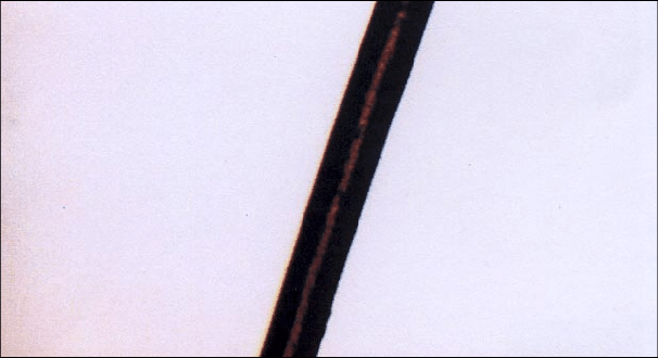 healthy hair strand under a microscope