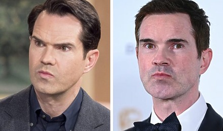 Jimmy Carr Hair Transplant: Everything You Need To Know