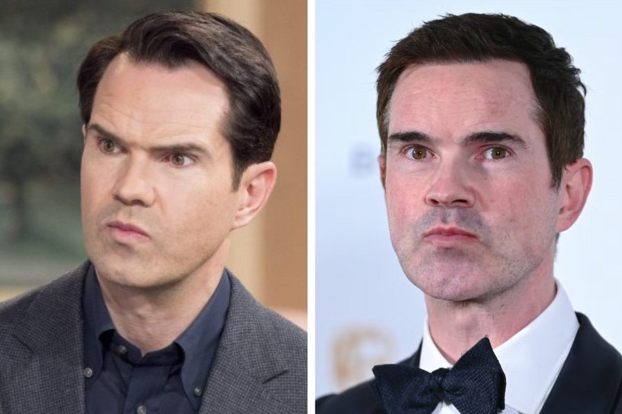 Jimmy Carr Hair Transplant: Everything You Need To Know