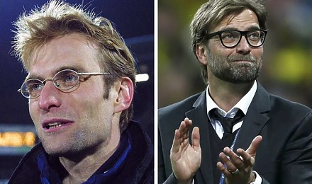 Jurgen Klopp Hair Transplant: Everything You Need To Know