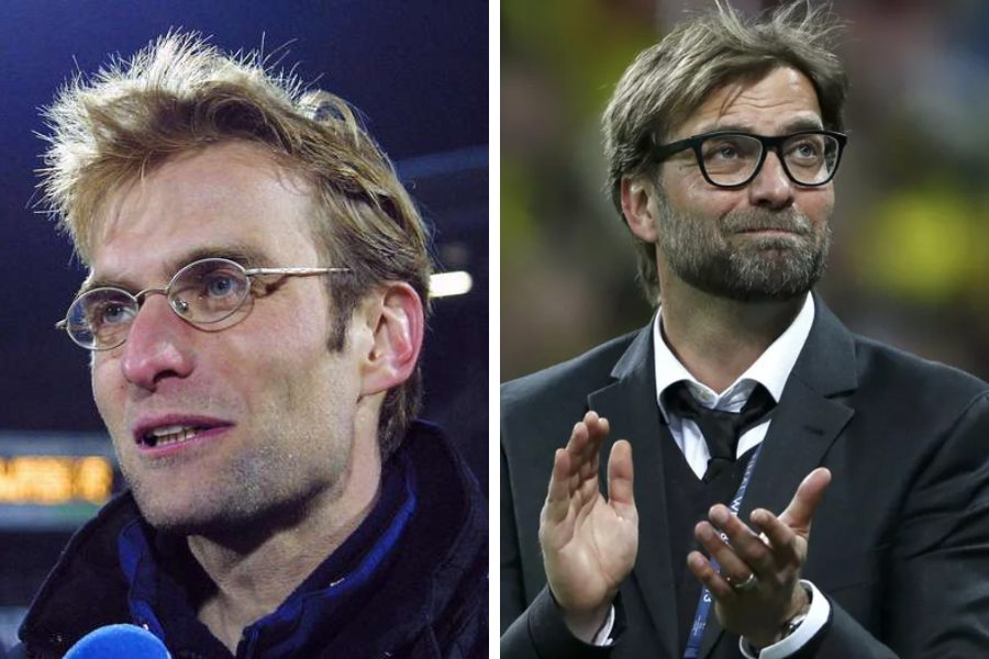 Jurgen Klopp Hair Transplant: Everything You Need To Know