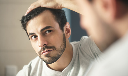 Should You Get A Second Hair Transplant?