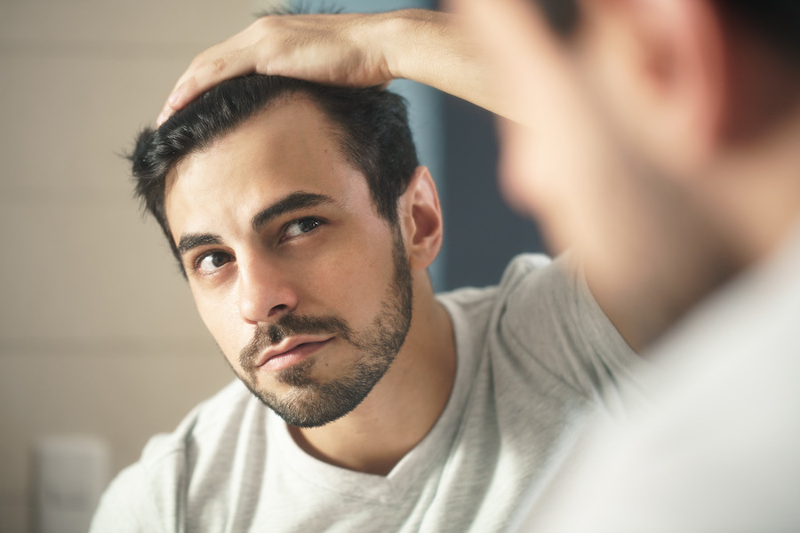 Should You Get A Second Hair Transplant?