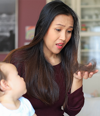 woman experiencing post partum hair loss