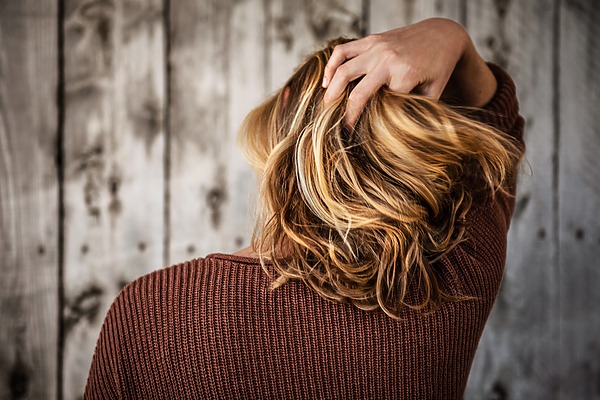 Do I Have Dandruff or Scalp Psoriasis? Flaking Scalp Causes, Treatment, and Prognosis